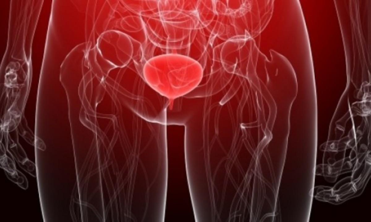 Αυτά είναι τα σημάδια που δείχνουν ότι έχετε πάθει ουρολοίμωξη