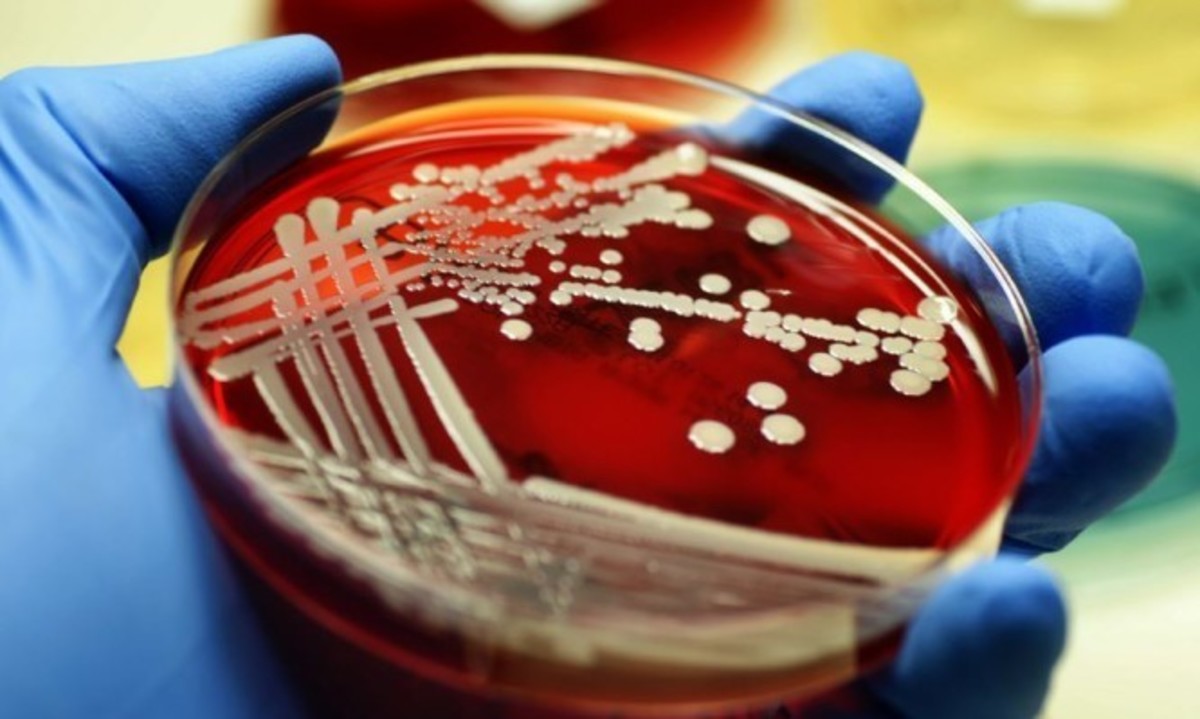 Σταφυλόκοκκος: Πώς εκδηλώνεται – Ποια σημάδια θέλουν προσοχή