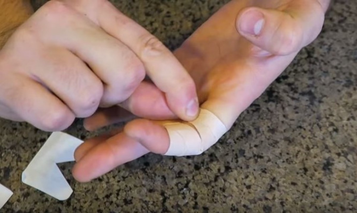 Και όμως βάζετε το τραυμαπλάστ με λάθος τρόπο τόσα χρόνια! Δείτε πώς γίνεται σωστά