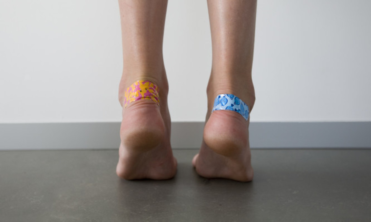 Φουσκάλες στα πόδια: Τα λάθη που κάνετε και τις επιδεινώνουν