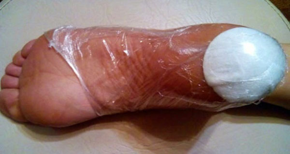 Τυλίγει την φτέρνα της με πλαστική μεμβράνη και κάτι ακόμα – Δείτε τι μοναδικό πετυχαίνει έτσι!