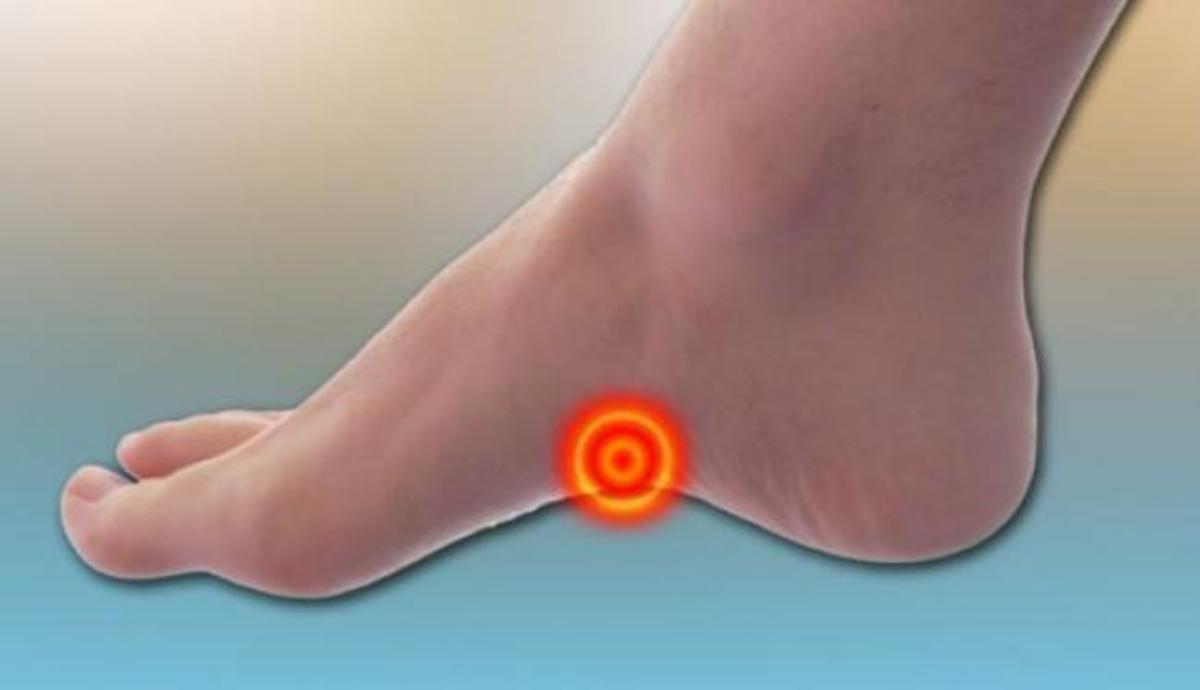 Τι να κάνετε όταν πονάτε σε αυτό το σημείο του πέλματος – Γιατί και πότε συμβαίνει