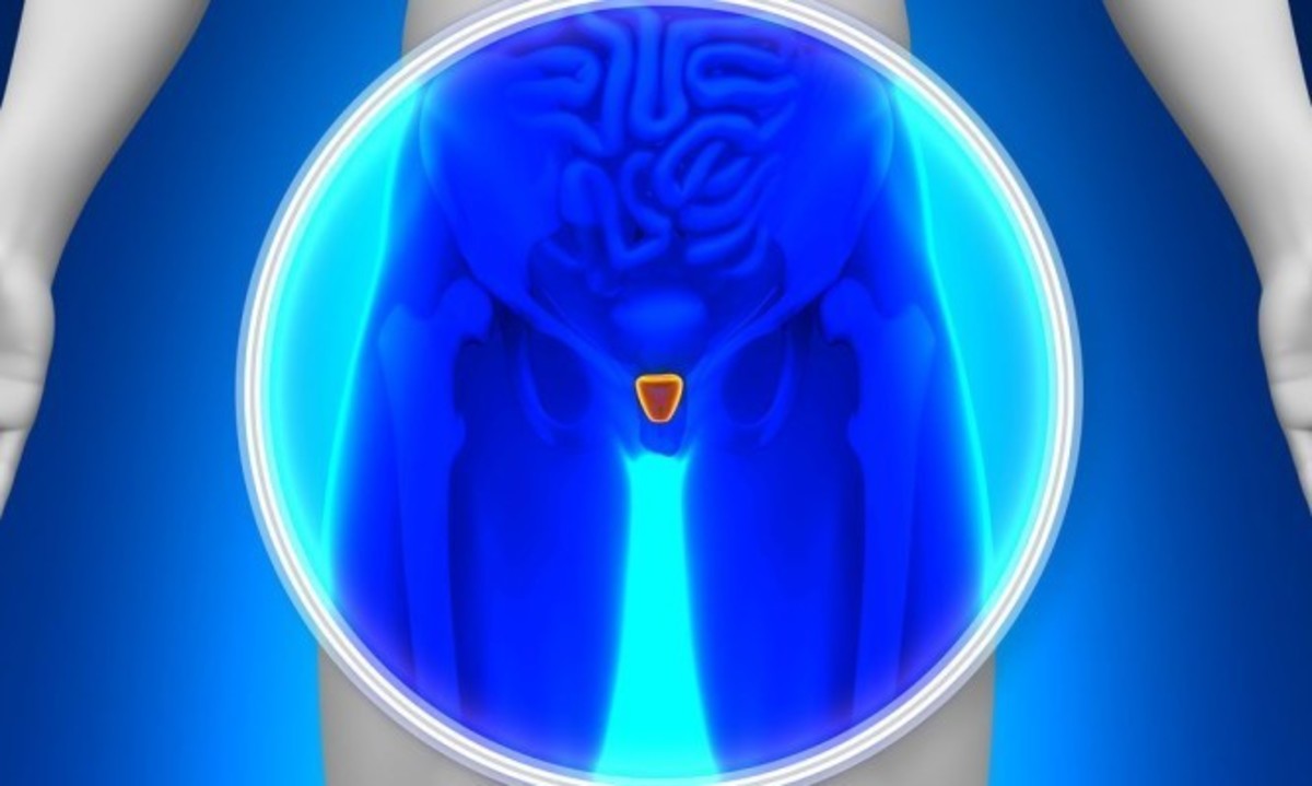 Καρκίνος των όρχεων: Αίτια, συμπτώματα, διάγνωση και αντιμετώπιση