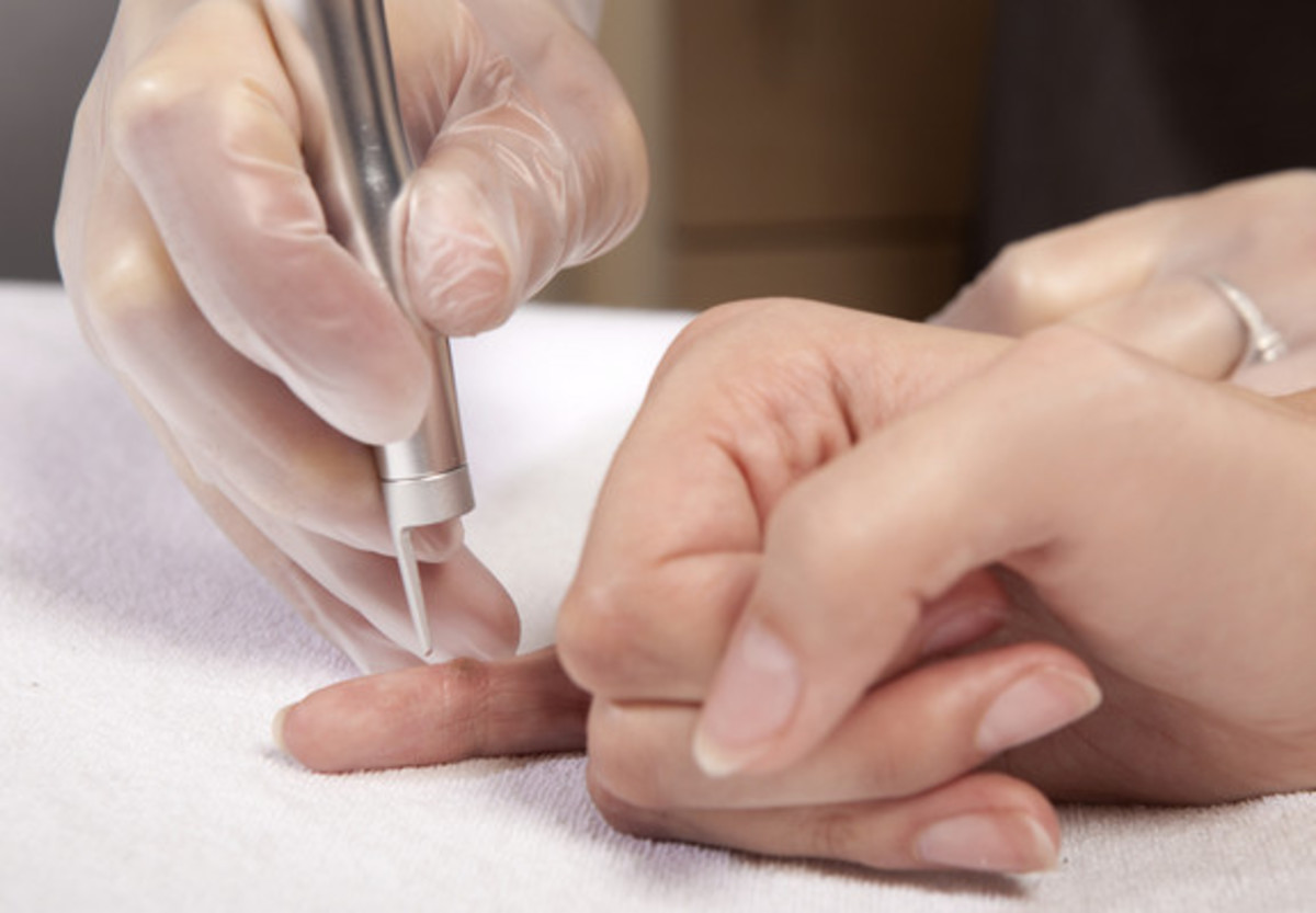 Όσα πρέπει να ξέρετε για να προστατευθείτε από τα κονδυλώματα