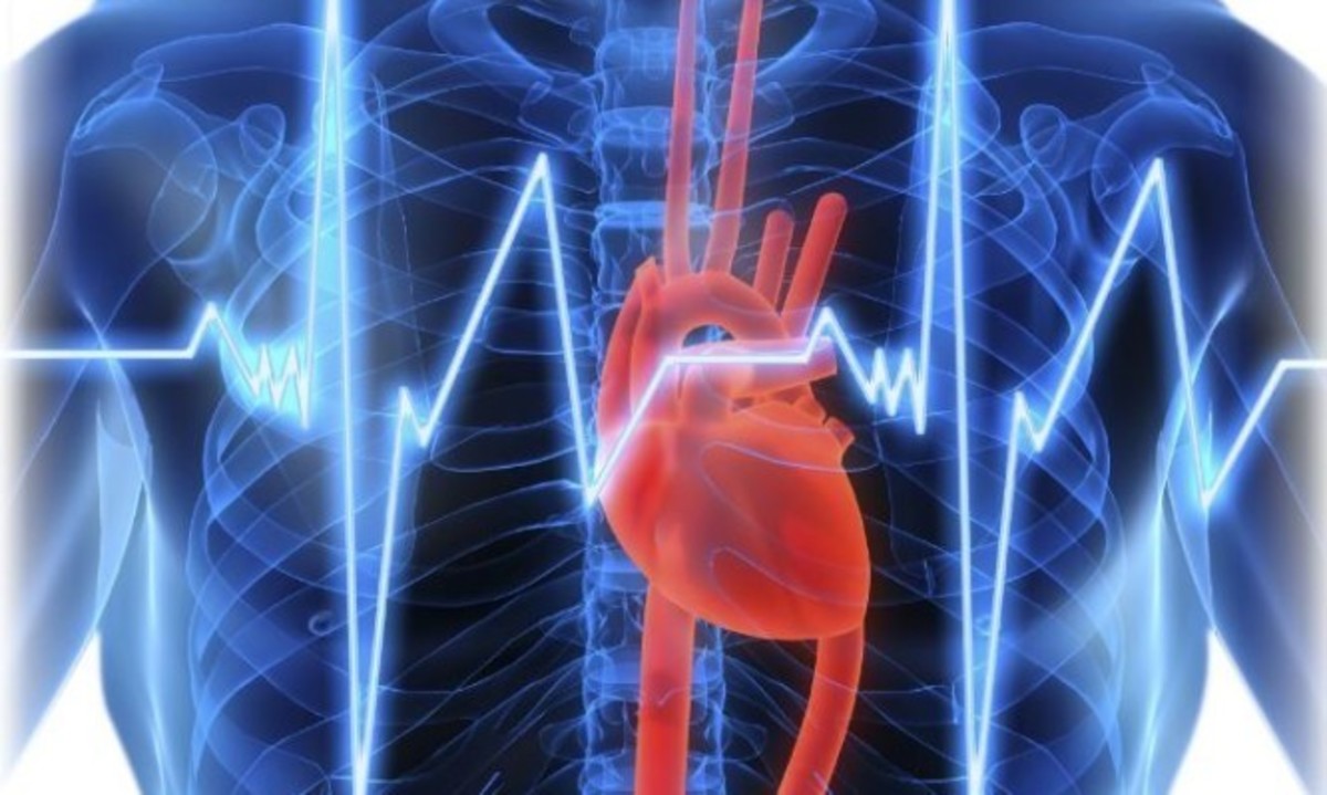 Κολπική μαρμαρυγή: Όλα τα συμπτώματα, οι παράγοντες κινδύνου και οι κανόνες πρόληψης