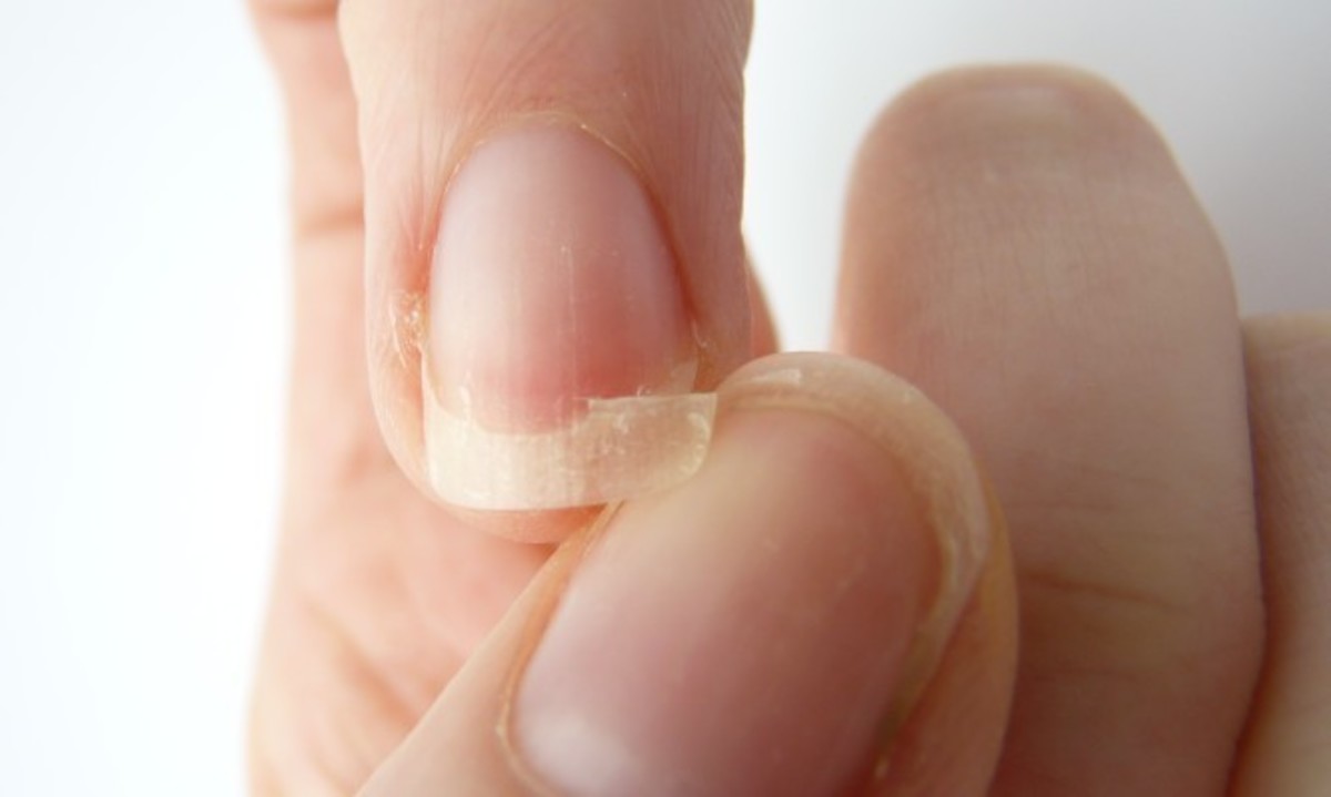 Τι να κάνετε αν σπάσει το νύχι σας