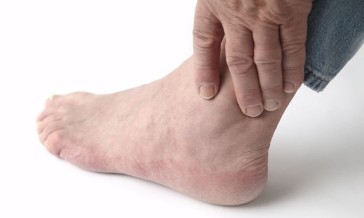 Ουρικό οξύ: Ποιες τροφές ωφελούν και ποιες βλάπτουν