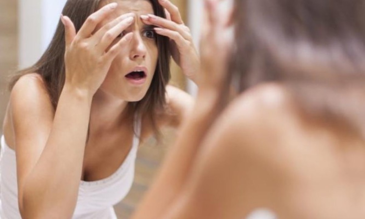 Πώς φεύγει γρήγορα ένα σπυράκι – Τρεις άμεσες λύσεις για… επείγουσα ανάγκη