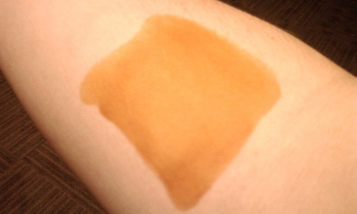 Τεστ: Πώς φαίνεται αν ο θυρεοειδής σας χρειάζεται ιώδιο (ΒΙΝΤΕΟ)