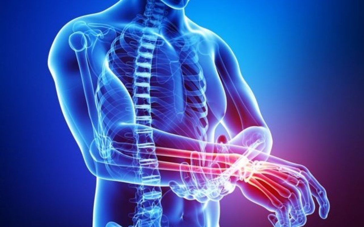 Αρθρίτιδα: Δεν φαντάζεστε τι κάνει το τσιγάρο για τους πόνους!