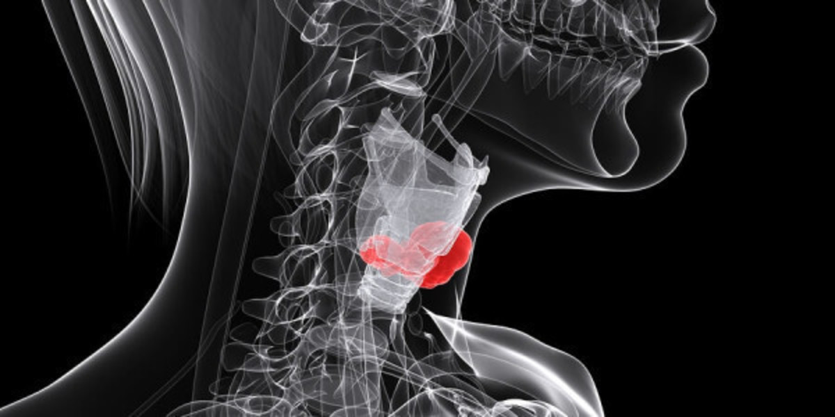 Προσοχή στα συμπτώματα που δείχνουν νόσο Χασιμότο του θυρεοειδούς