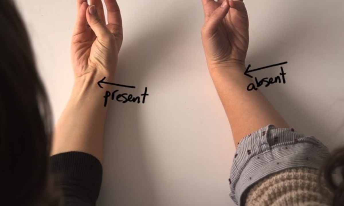 Απίστευτο: Η απόδειξη της θεωρίας του Δαρβίνου στο σώμα σας! (ΒΙΝΤΕΟ)