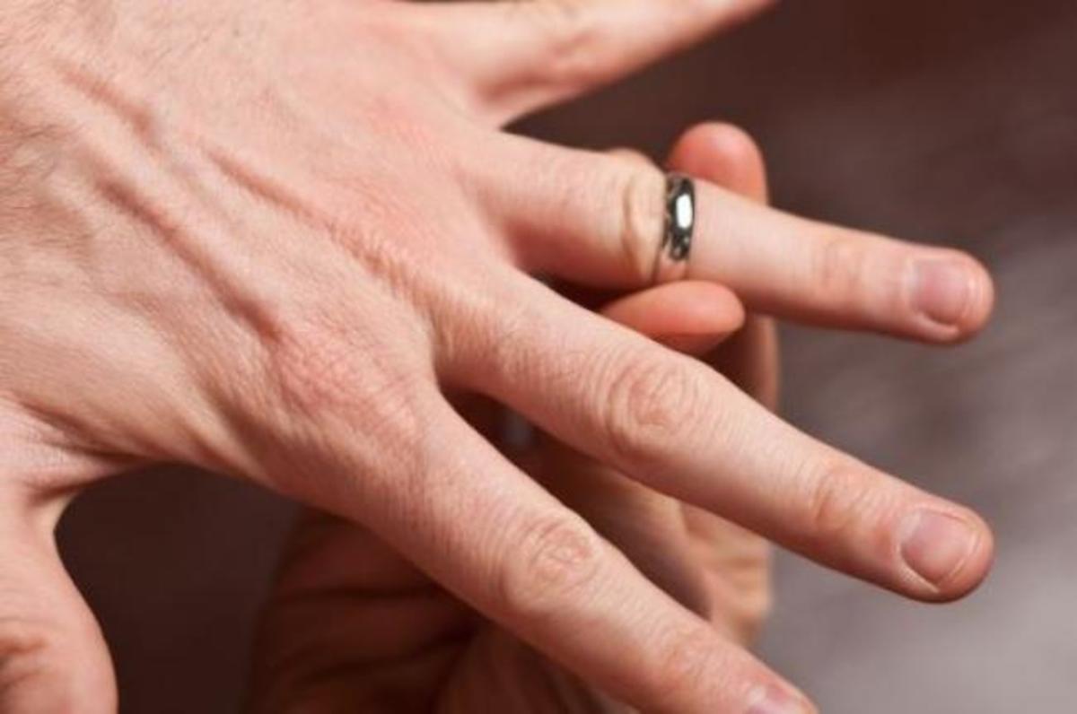 Το κόλπο που κάνουν στα νοσοκομεία για να αφαιρούν το δαχτυλίδι που έχει κολλήσει