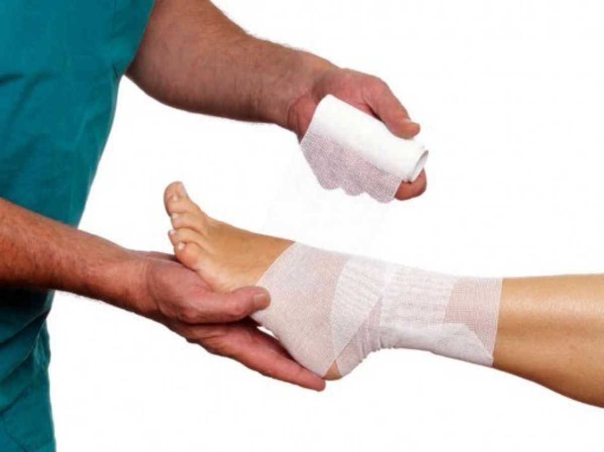 Διάστρεμμα αστραγάλου: Τι πρέπει να ξέρετε για σωστή θεραπεία