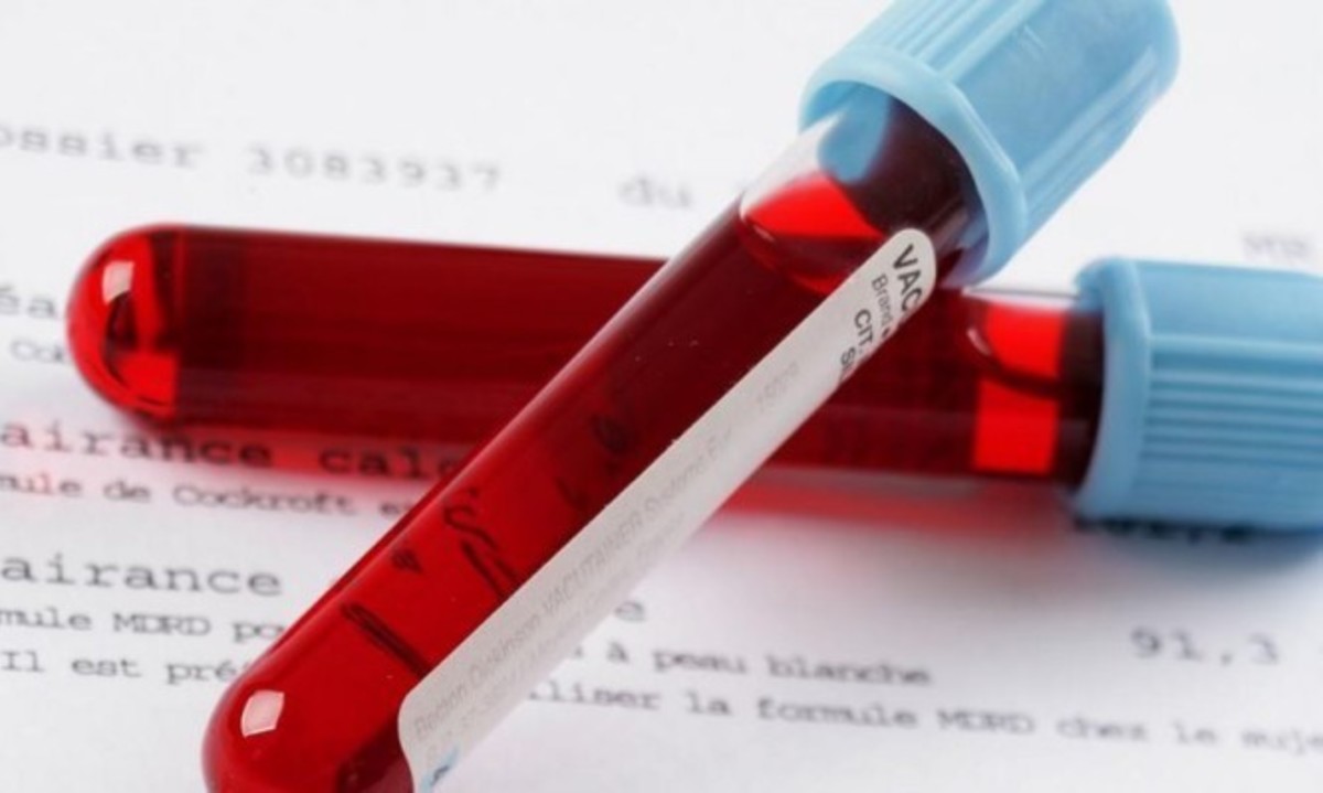 Πώς να αυξήσετε τη φερριτίνη στο αίμα σας μέσω της διατροφής