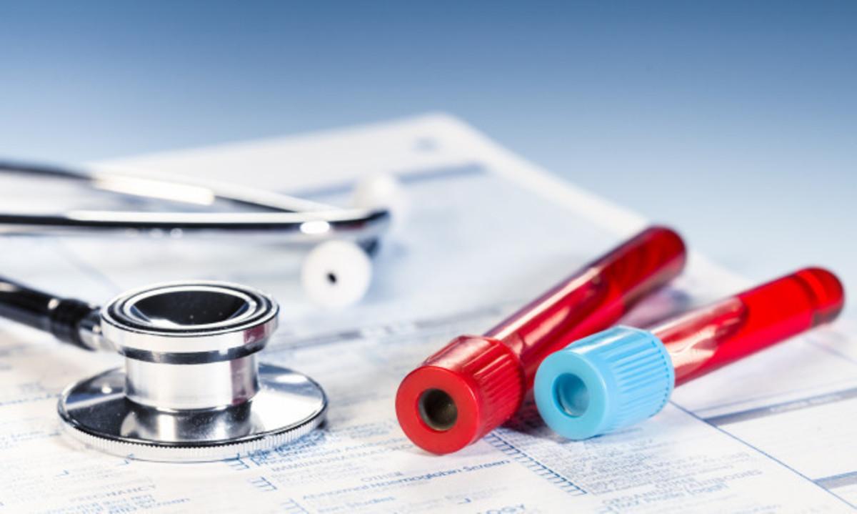 Γιατί και κάθε πότε πρέπει να κάνετε γενική εξέταση αίματος