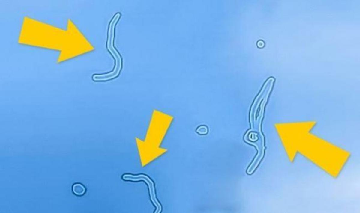 Τι είναι ΑΥΤΑ τα σημάδια που βλέπετε καμιά φορά να… αιωρούνται στα μάτια σας (ΒΙΝΤΕΟ)