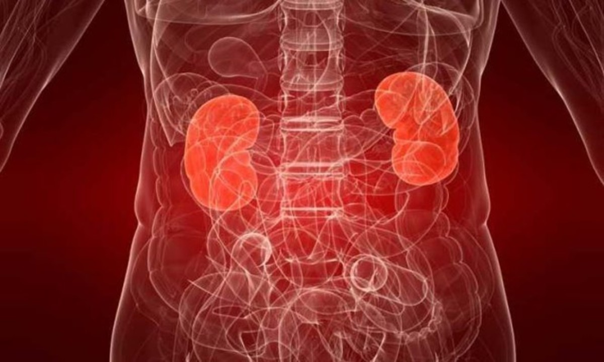 Πυελονεφρίτιδα: Ποια προβλήματα στην ούρηση πρέπει να προσέχετε