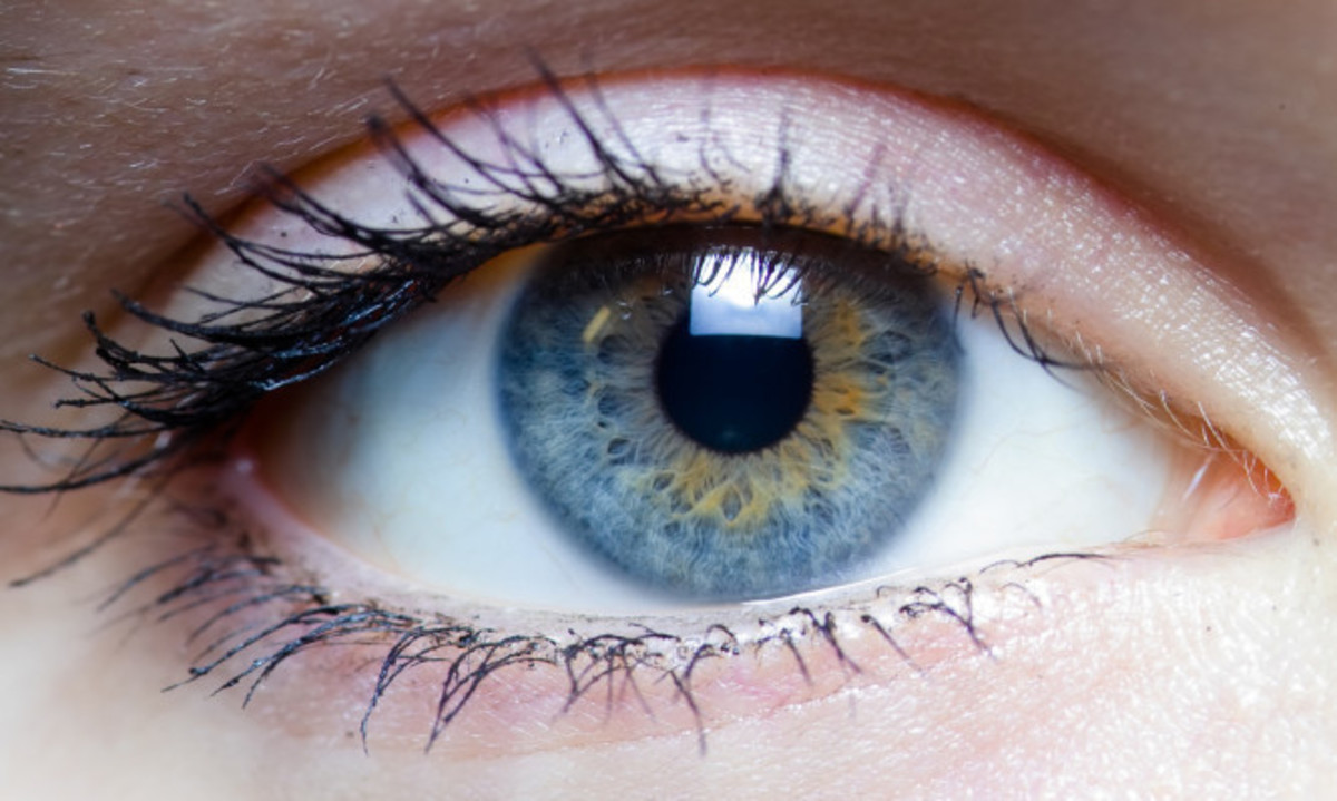 Αστιγματισμός: Το τεστ της μιας εικόνας που αποκαλύπτει αν έχετε πρόβλημα