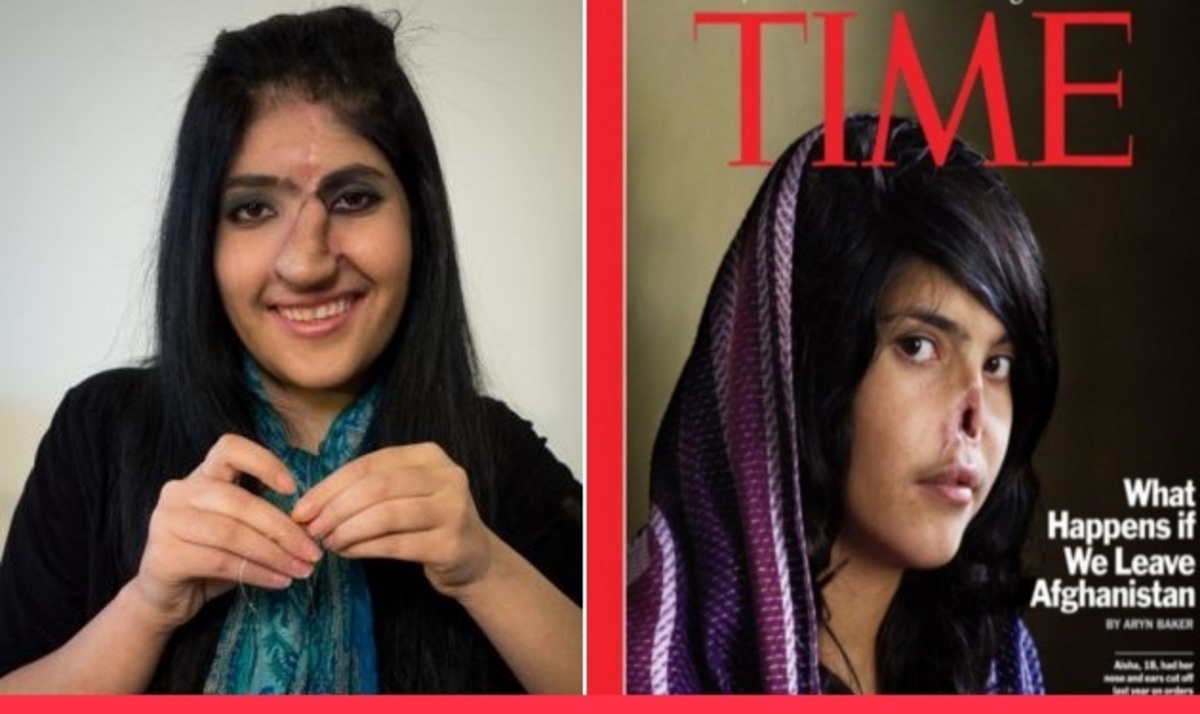 Το νέο πρόσωπο της Αφγανής που έγινε εξώφυλλο στο Time μετά τα βασανιστήρια που υπέστη
