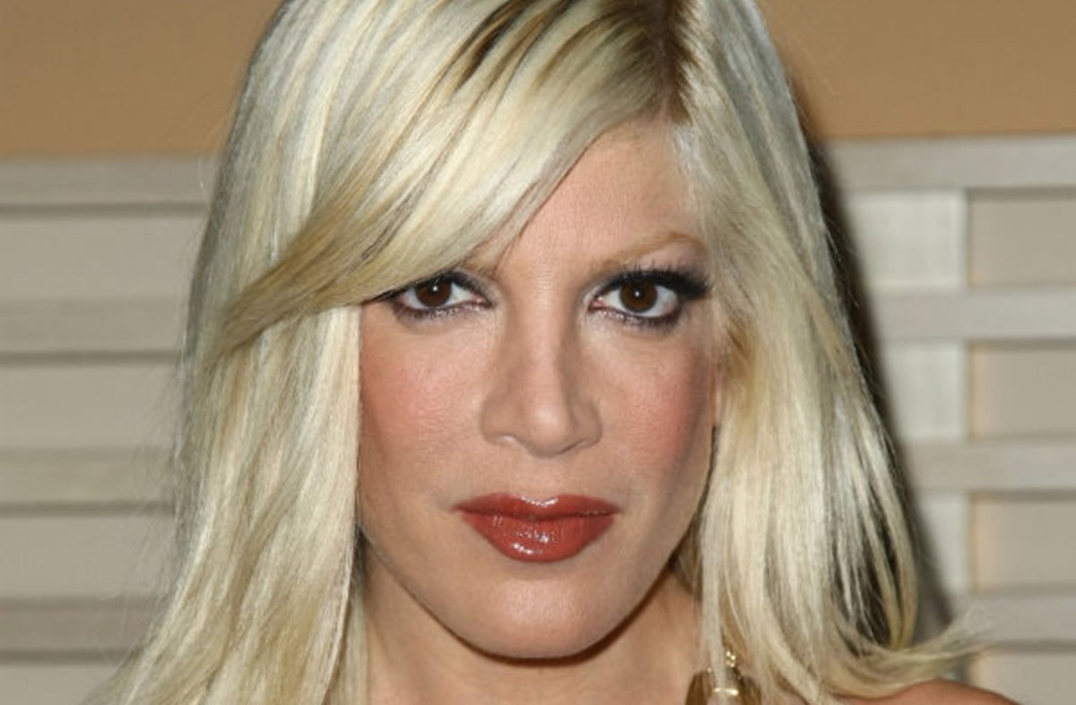 Σοκάρουν οι φωτογραφίες της Tori Spelling με τη φρικτή όψη της μετά από χημικό πίλινγκ!