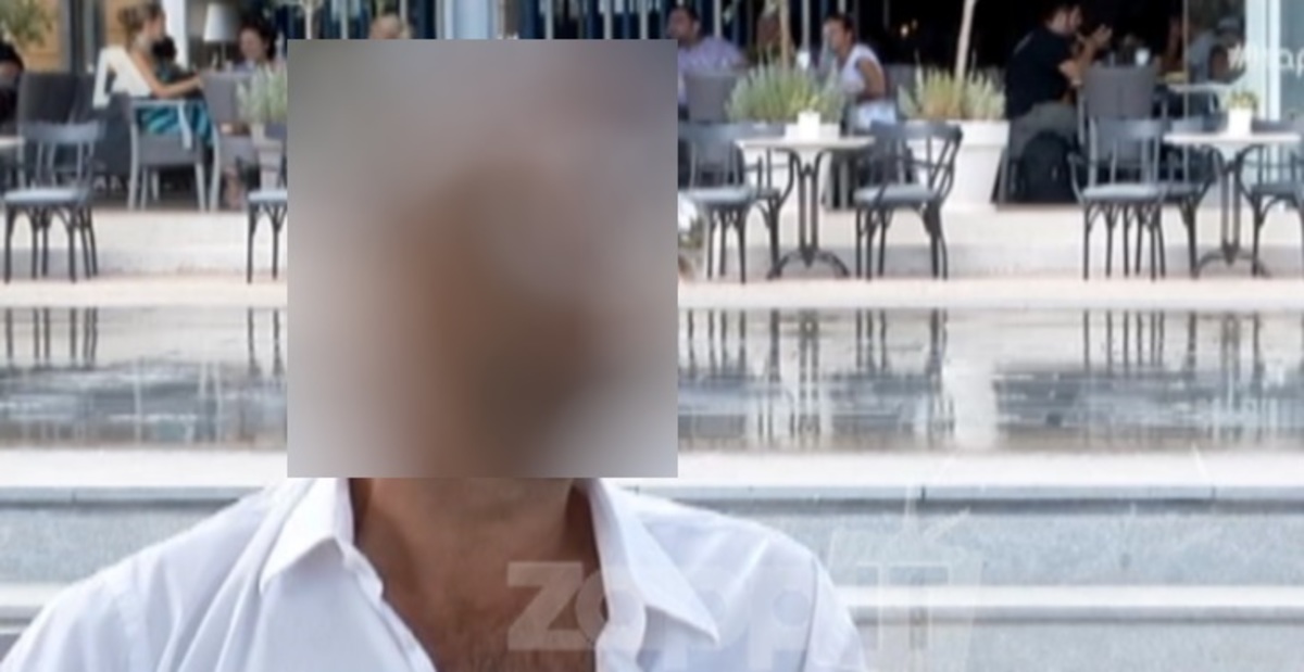 Η αποτυχημένη μεταμόσχευση μαλλιών Έλληνα τραγουδιστή και το σημάδι που του άφησε