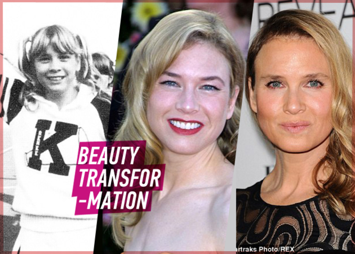 Η… μεταμόρφωση της Renee Zellweger τα τελευταία 20 χρόνια!