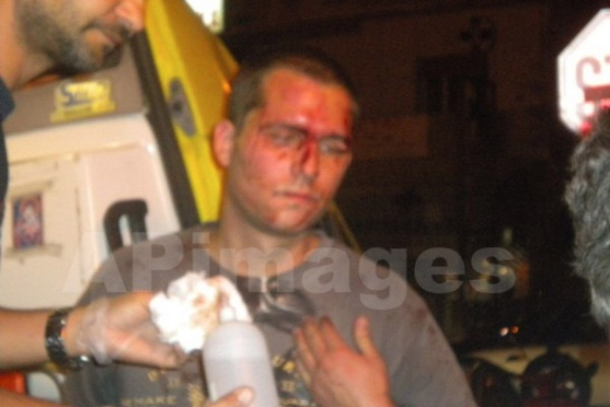 Αναζητείται 24χρονος που γρονθοκόπησε δημοτικό σύμβουλο στην Α.Παρασκευή – Το δραματικό τηλεφώνημα του πατέρα