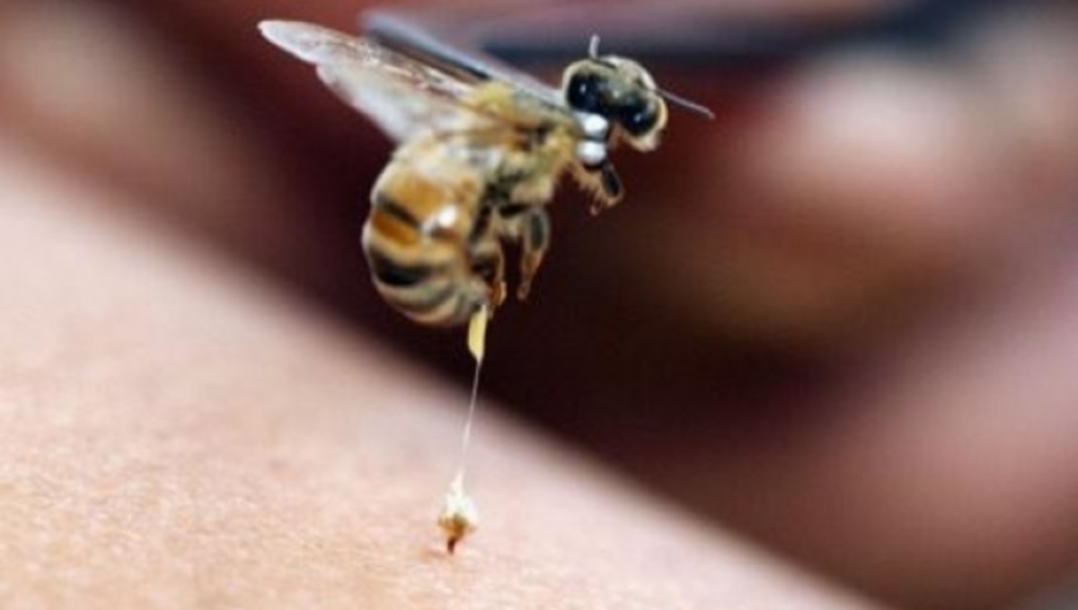 Τα σωστά βήματα σε περίπτωση τσιμπήματος από μέλισσα ή σφήκα