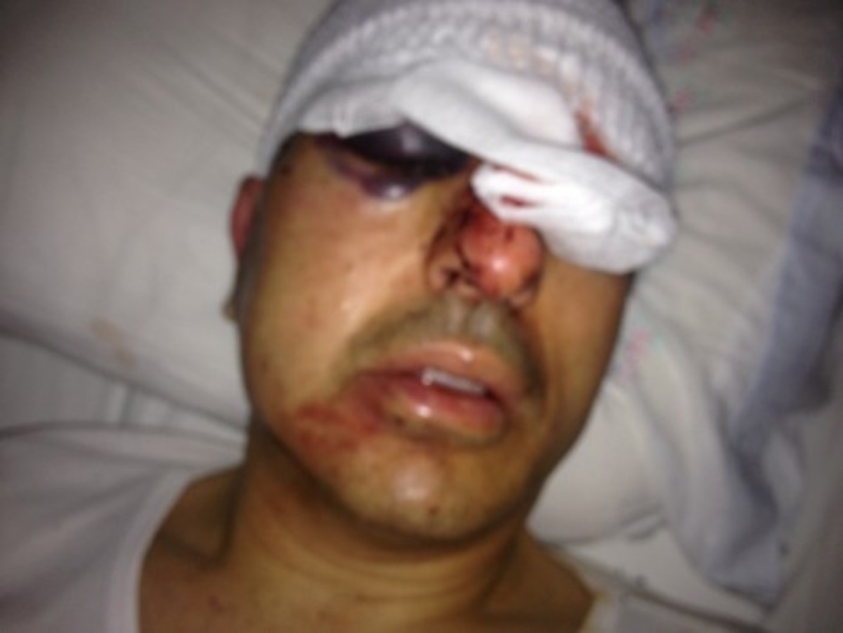 Αντιδήμαρχος για απόπειρα δολοφονίας