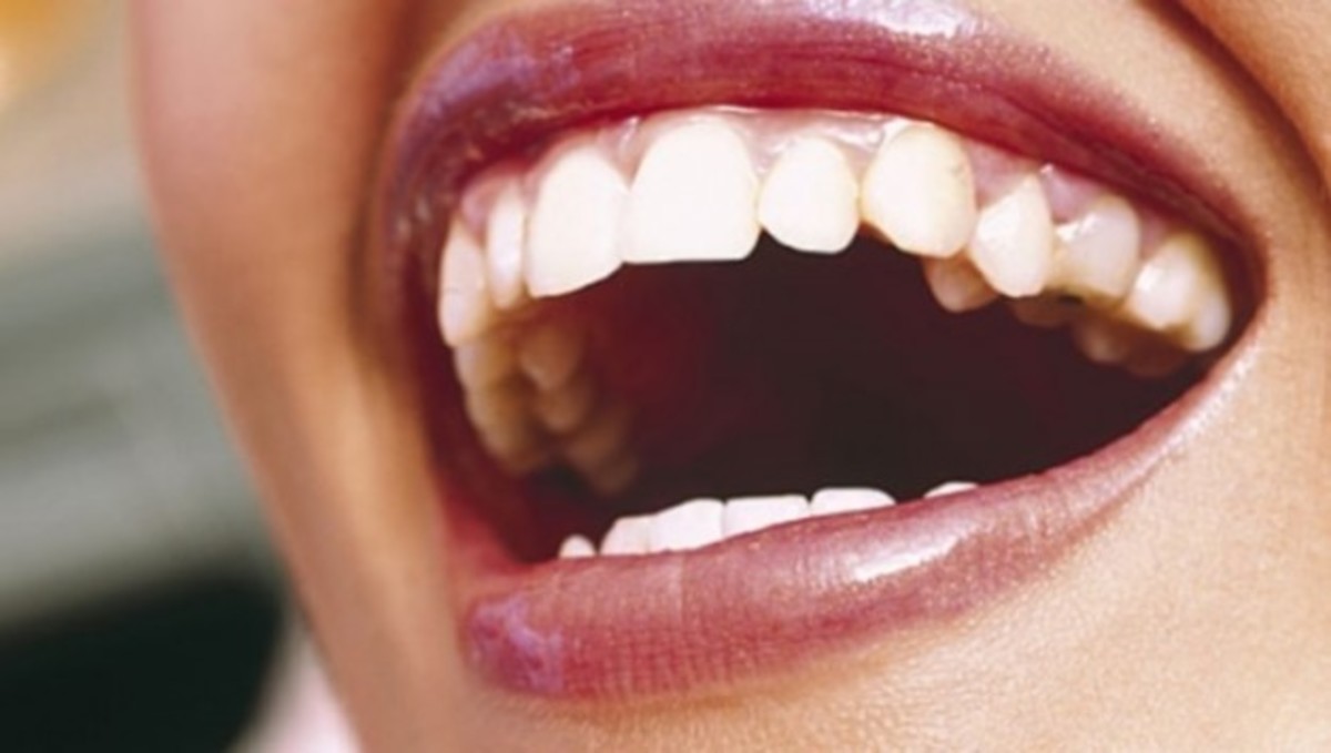 Τρώγοντας έρχεται το… αστραφτερό χαμόγελο!