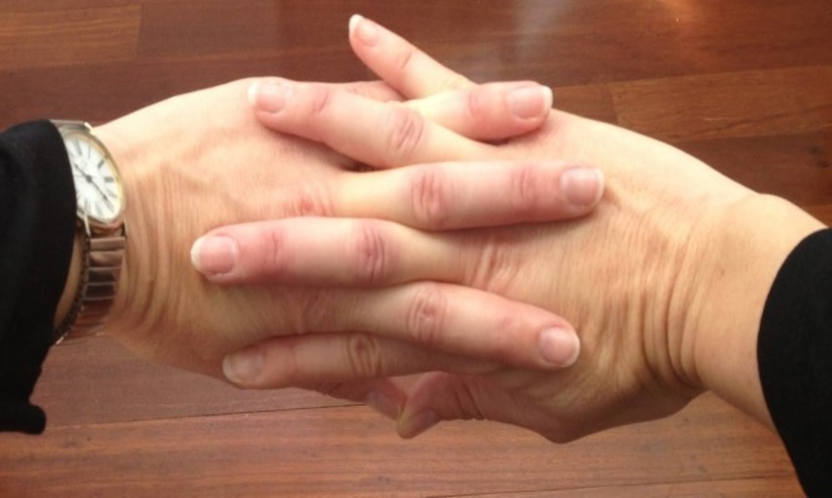 Αν κάνετε “κρακ” στα δάχτυλα πρέπει να δείτε τι έδειξε νέα έρευνα… (ΒΙΝΤΕΟ)