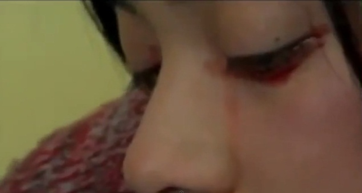 Απίστευτο! Τα δάκρυά της είναι από αίμα! (VIDEO)