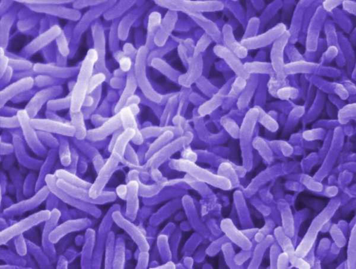 Γιατί η Βρετανία θα ψεκάζει τα αεροσκάφη με εντομοκτόνα για τον ιό Ζίκα