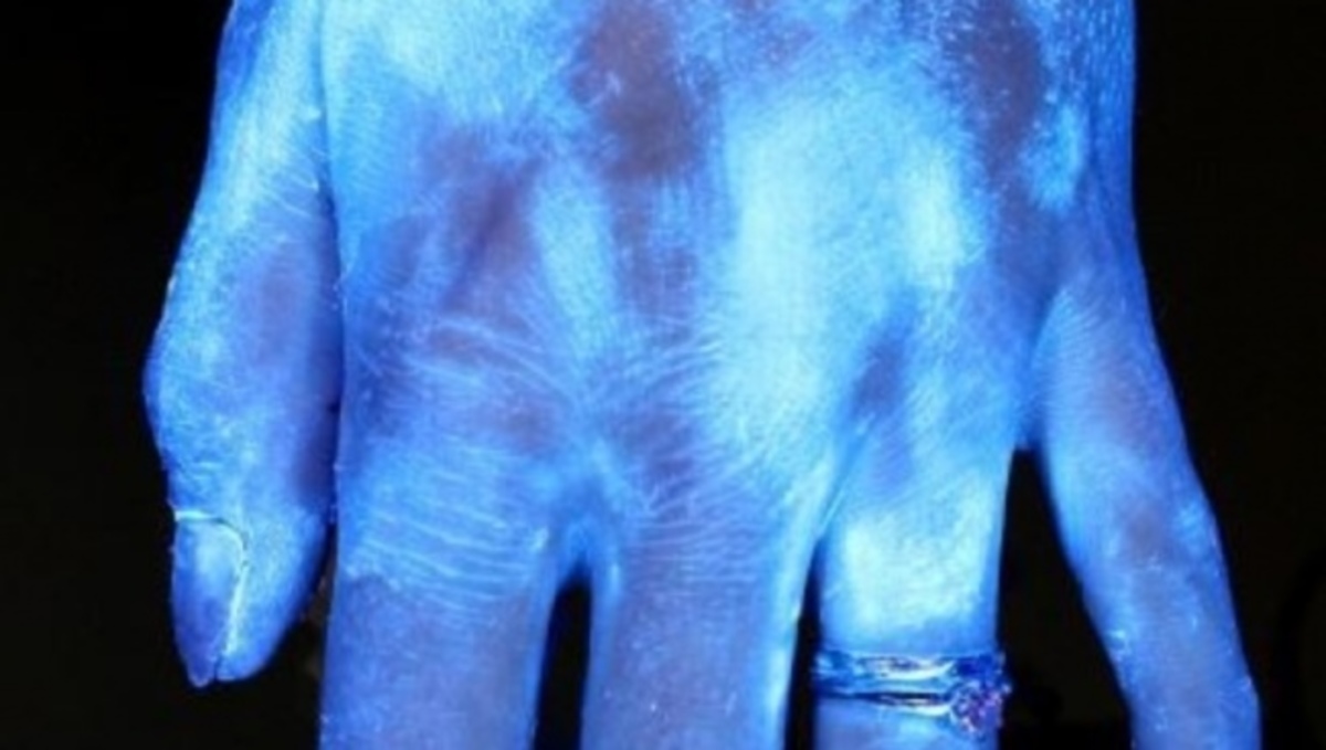 Τεστ με υπεριώδες φως: Δείτε πόσα βακτήρια μένουν στα χέρια αφότου τα πλύνετε (φωτογραφίες)