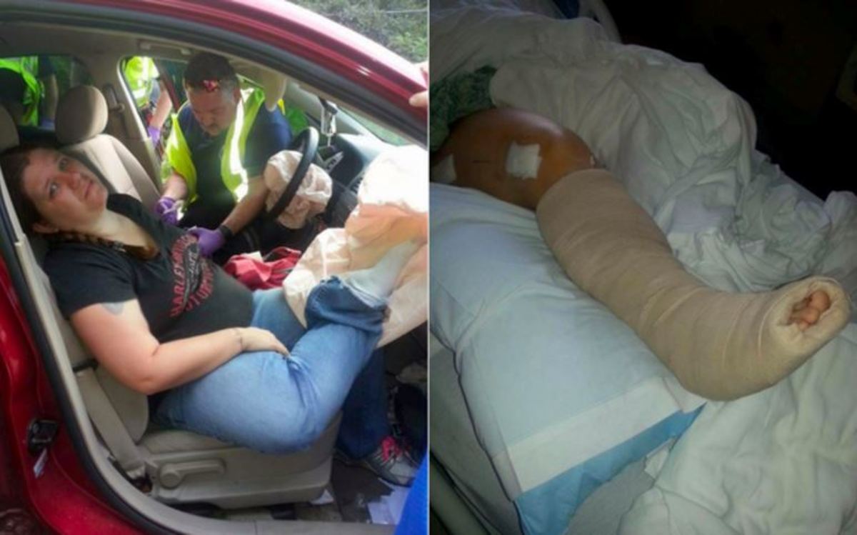 Γιατί να μην βάζετε ΠΟΤΕ τα πόδια στο ταμπλό του αυτοκινήτου – Δείτε τι της έκανε ο αερόσακος σε ελαφρύ τρακάρισμα [vid, pics]