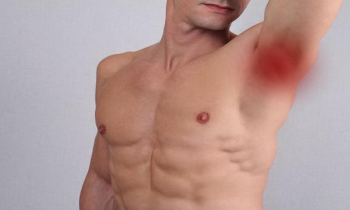 Ελέγξτε αν έχετε κι εσείς «γρομπαλάκι» στην μασχάλη: Τι μπορεί να είναι – Πότε πρέπει να ανησυχήσετε