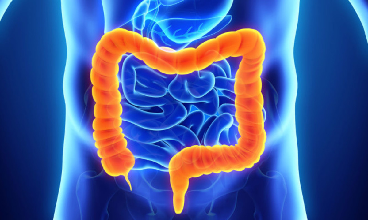 Καρκίνος του παχέος εντέρου: Με αυτά τα συμπτώματα ξεκινάει [vid]