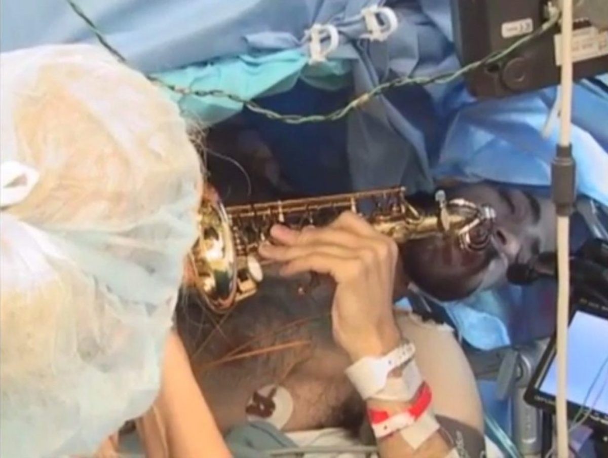 Έπαιζε σαξόφωνο ενώ του αφαιρούσαν όγκο από τον εγκέφαλο! [vid]