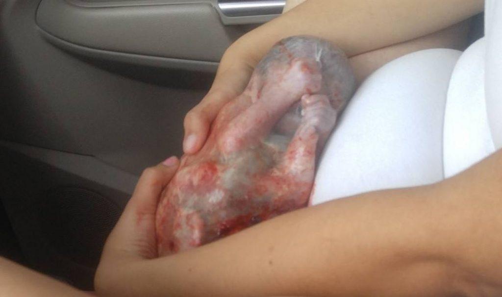 Γέννησε μέσα στο αμάξι: Απίστευτη εικόνα με το μωρό ακόμα ΜΕΣΑ στον αμνιακό σάκο! [pics]