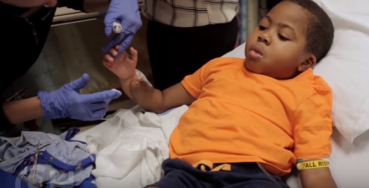 Πρωτοποριακή επέμβαση: Πέτυχε η μεταμόσχευση χεριών σε παιδί χωρίς άνω άκρα- Βίντεο