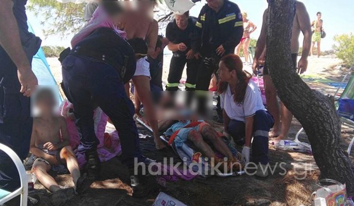 Χαλκιδική: Διακοπές… εφιάλτης! Στο νοσοκομείο 5μελής οικογένεια μετά από έκρηξη σε σκηνή