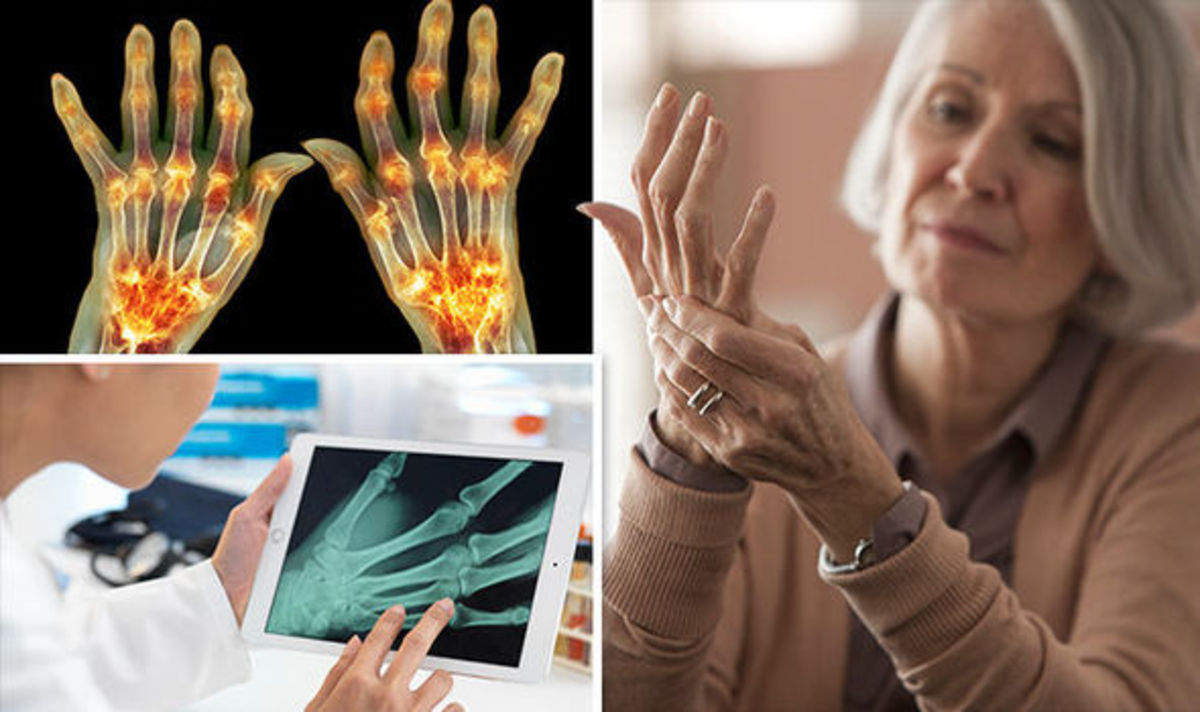 Αρθρίτιδα – Συμπτώματα: Μειώστε τον πόνο στις αρθρώσεις με αυτά τα συστατικά στο μαγείρεμα [vid]