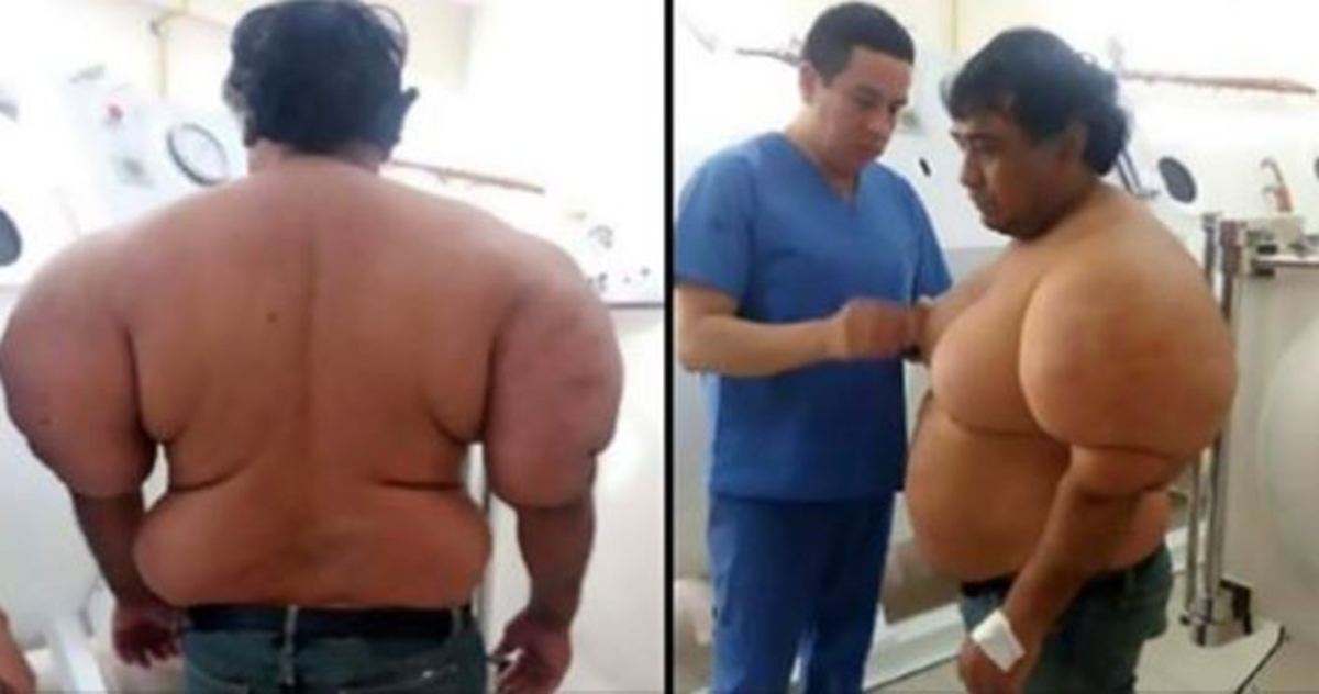 Δύτης έγινε ΕΤΣΙ επειδή δεν ακολούθησε τους κανόνες κατάδυσης – Τι είναι η νόσος των δυτών [vid, pics]