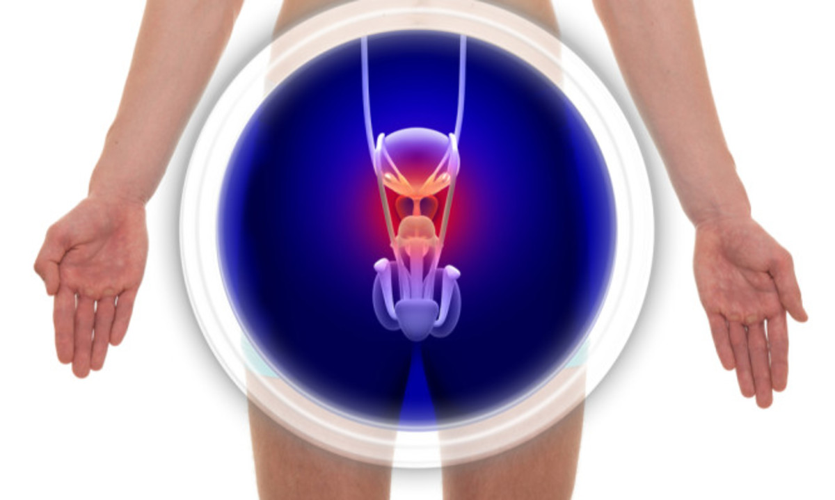 Καρκίνος του προστάτη: Τα πρώιμα συμπτώματα που πρέπει κάθε άντρας να γνωρίζει