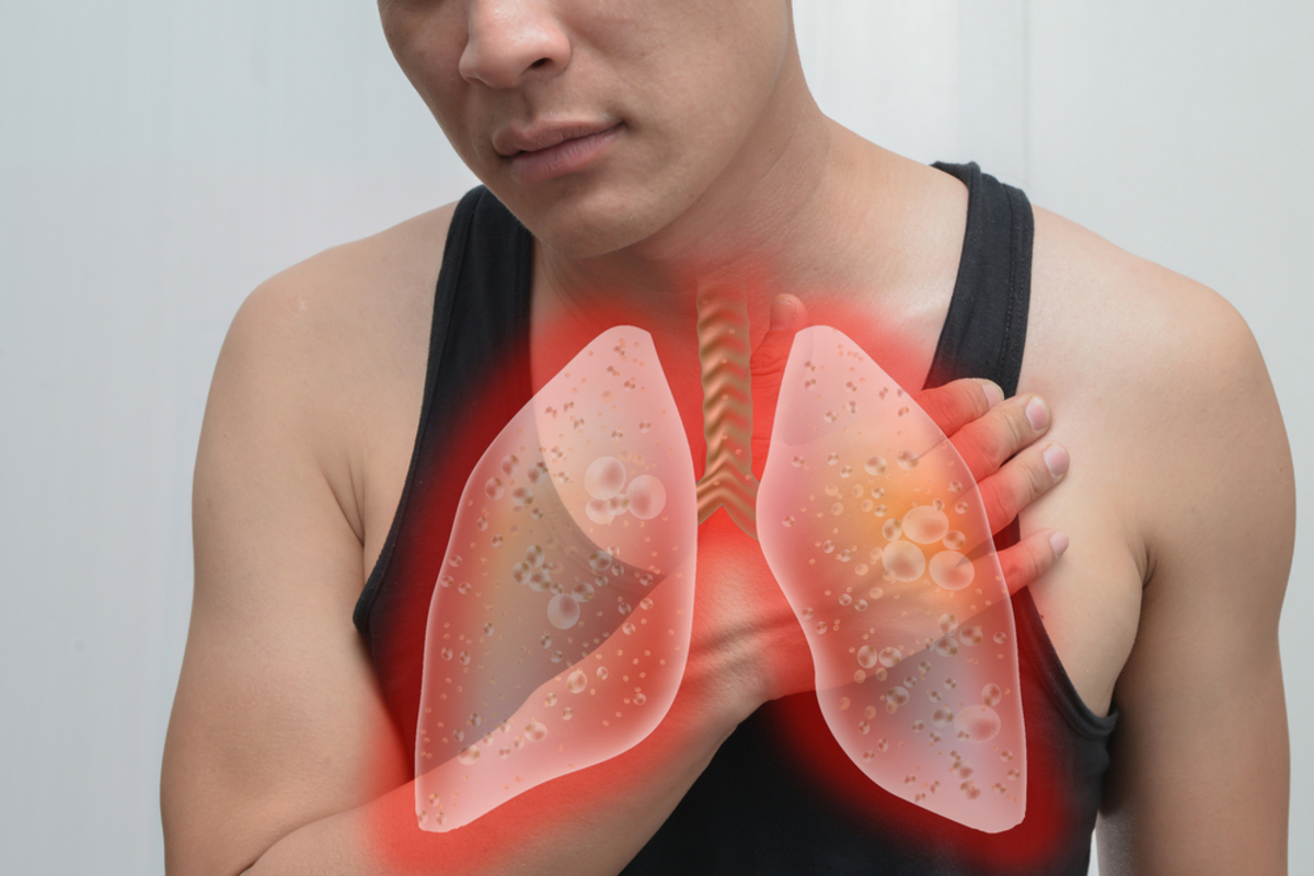 Καρκίνος του πνεύμονα και βήχας: Ποια είναι η σύνδεση;