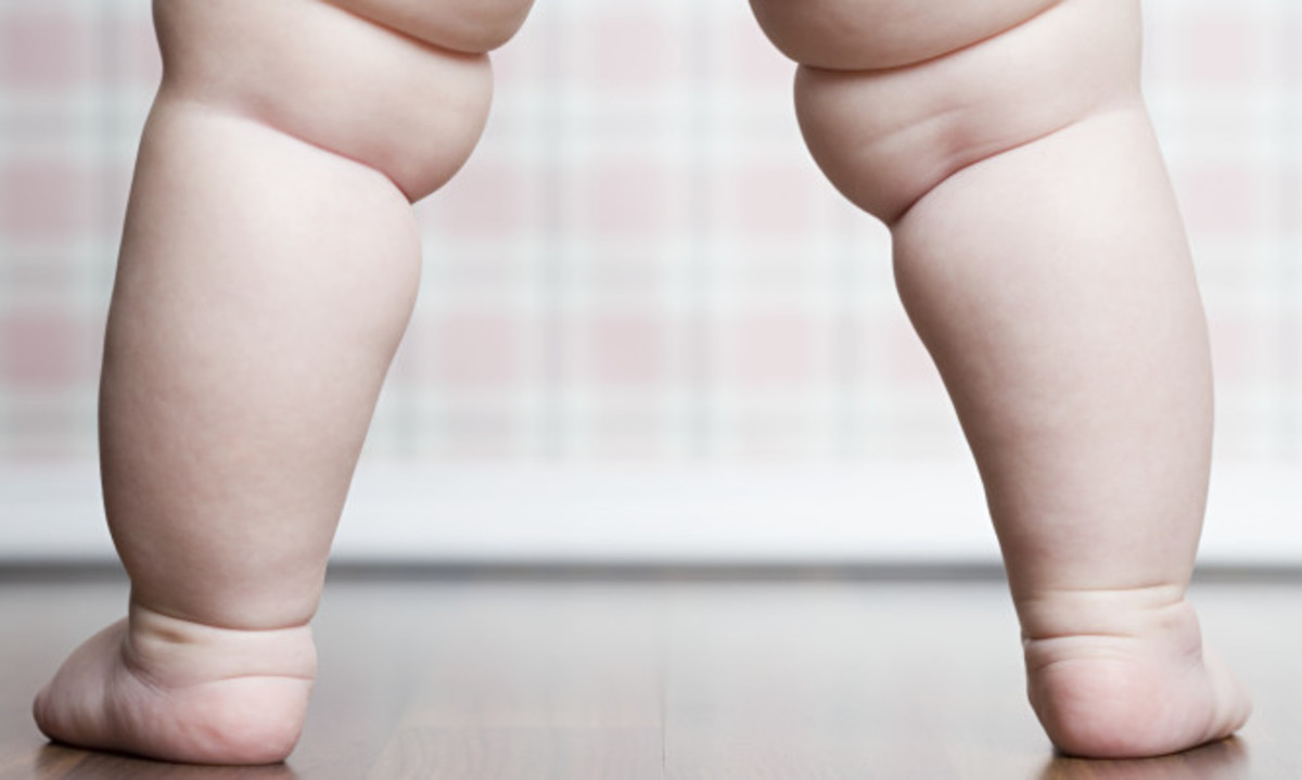 Πώς θα καταλάβετε από βρεφική ηλικία αν το παιδί έχει τάσεις παχυσαρκίας
