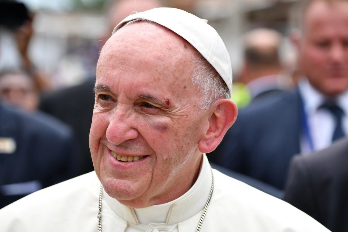Τραυματίστηκε στο κεφάλι ο Πάπας Φραγκίσκος! Με αίματα κυκλοφορούσε στην Καρταχένα [pics, vid]