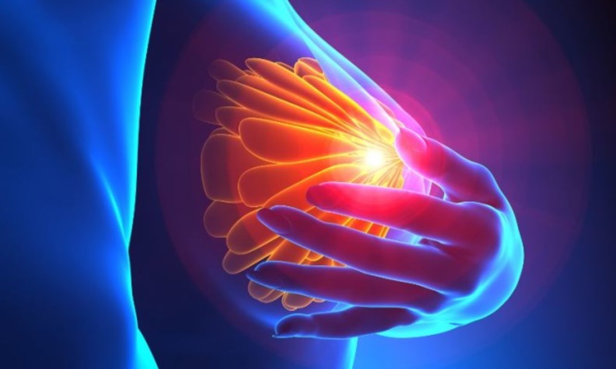 Φλεγμονώδης καρκίνος του μαστού: Συμπτώματα του πιο ύπουλου καρκίνου στο στήθος [vids]