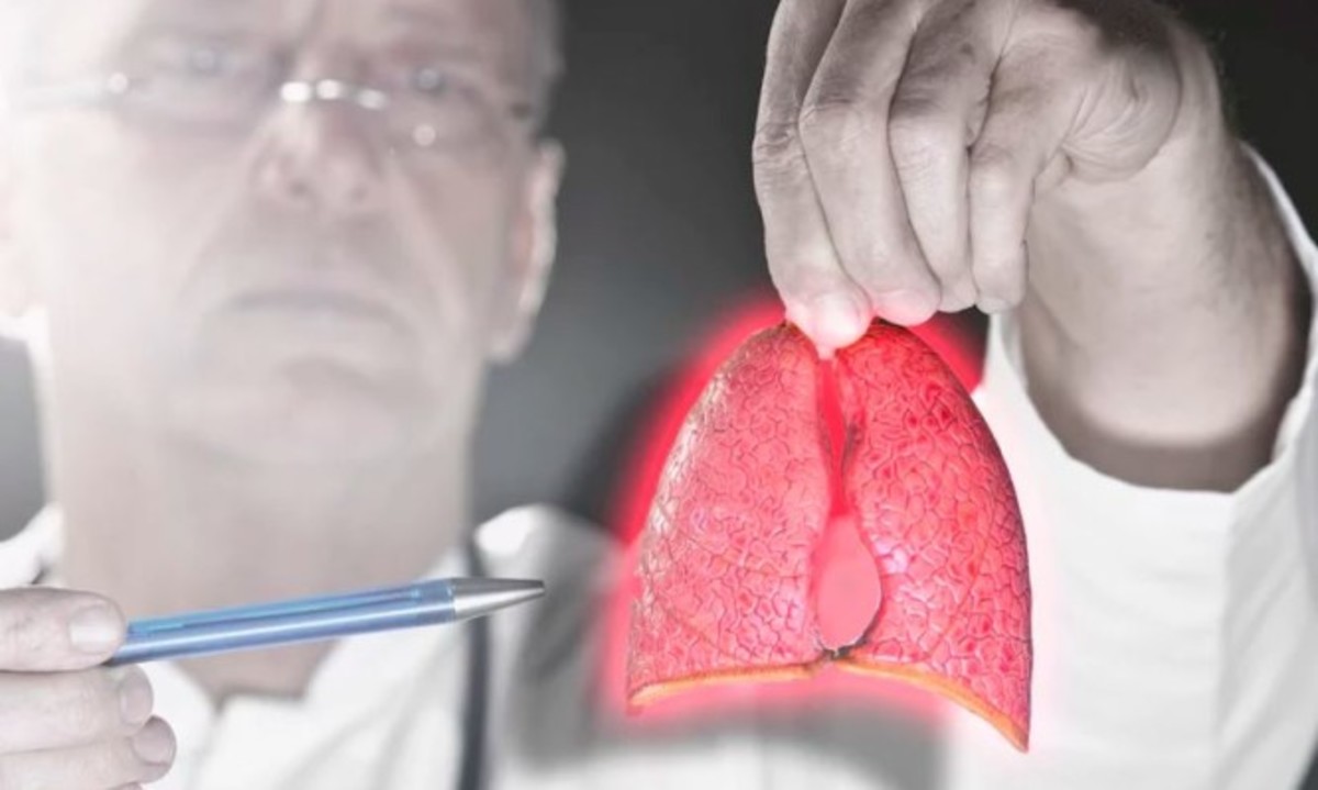 Καρκίνος του πνεύμονα: Πώς μπορεί να συμβεί σε όσους ΔΕΝ καπνίζουν!